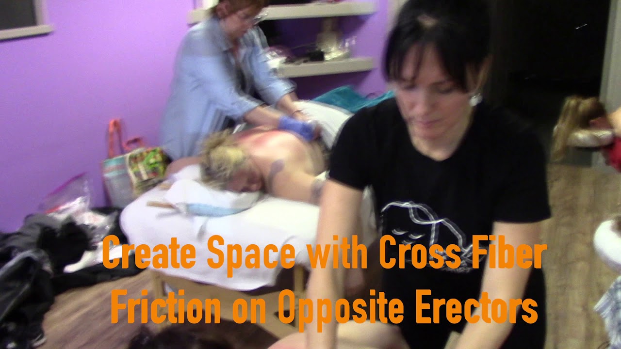 Cupping Massage: More Single & Double Sliding Cup Variations